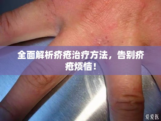 全面解析疥疮治疗方法，告别疥疮烦恼！